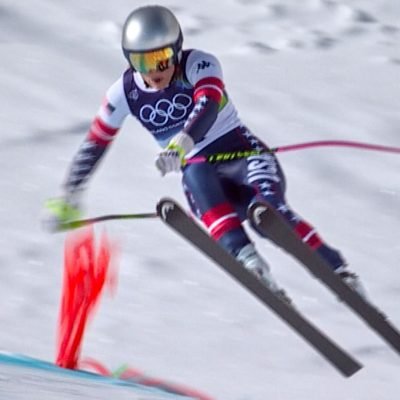 Lindsey Vonn reveals extent of injuries after Winter Olympics crash